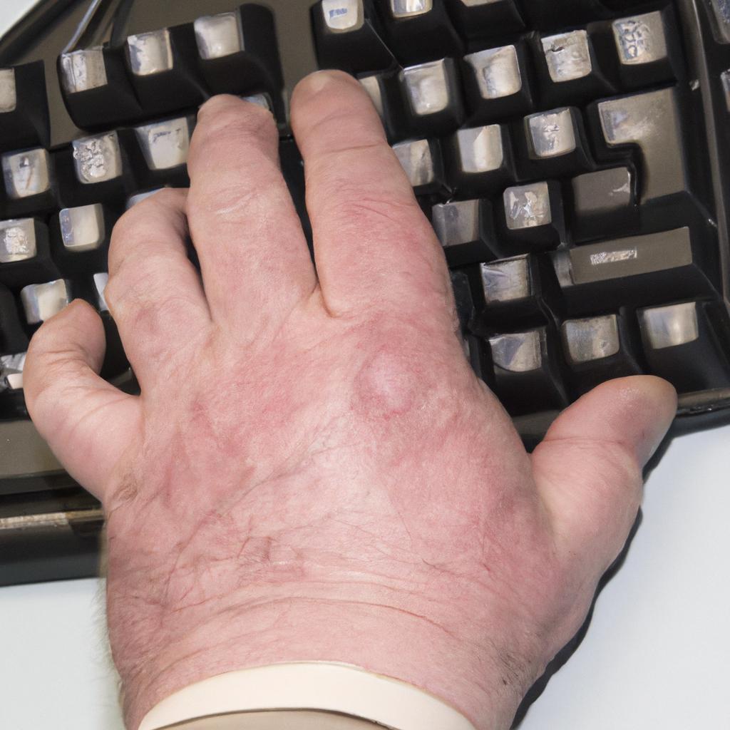 Ergonomic adjustments can help alleviate symptoms of stone hands for those who work at a desk.
